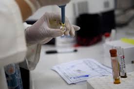 Prueban en los EE.UU vacuna contra el Zica