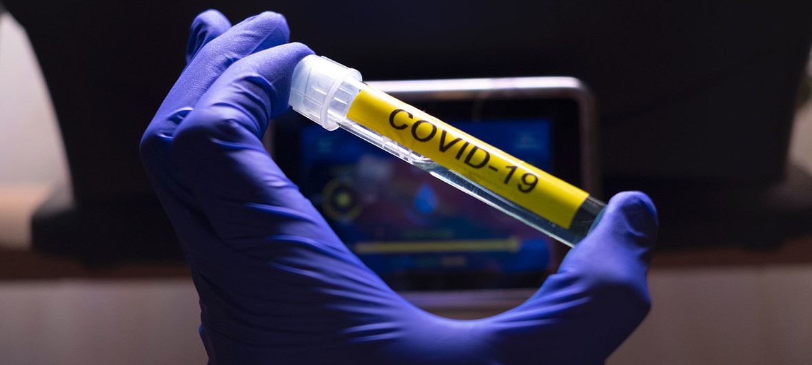 coronavirus en beaker