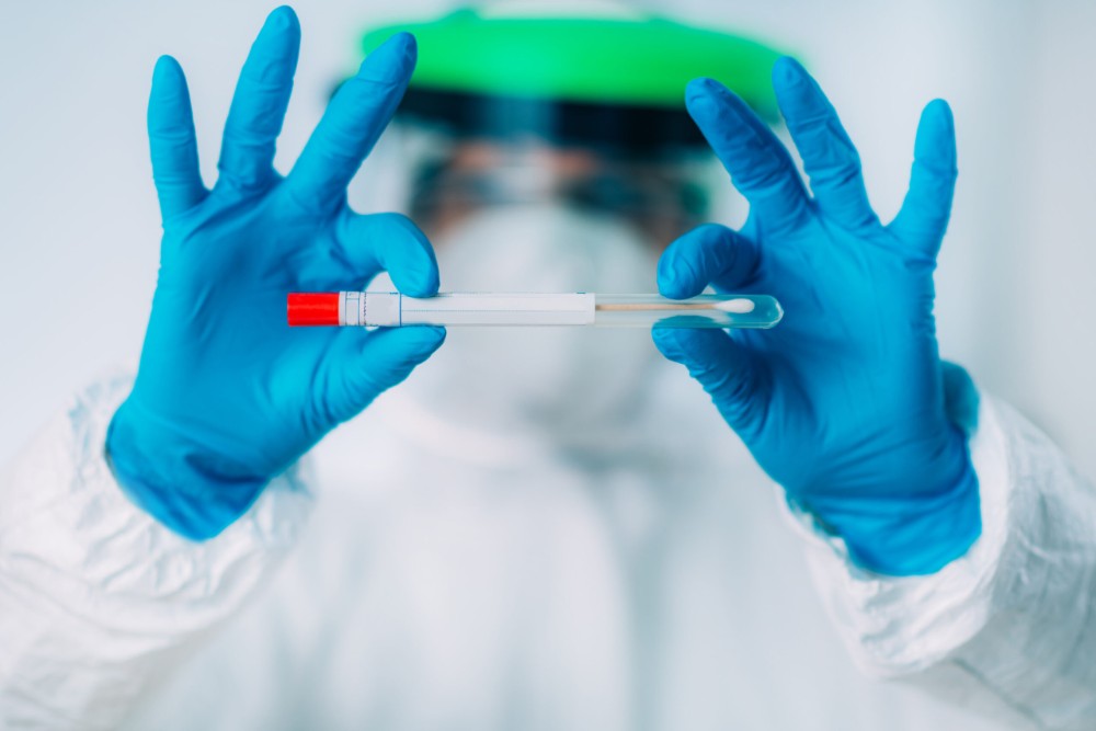 médico sostiene aplicador de prueba de PCR en las manos